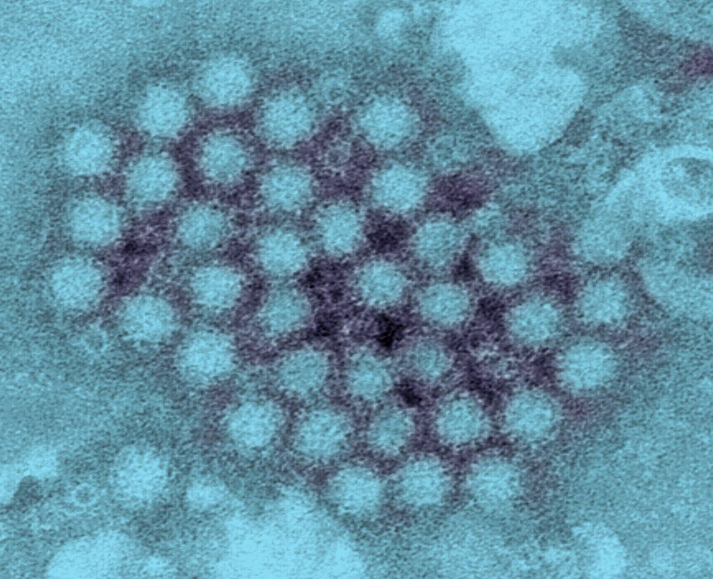 Negative stained transmission electron micrograph (TEM) of mumps virus