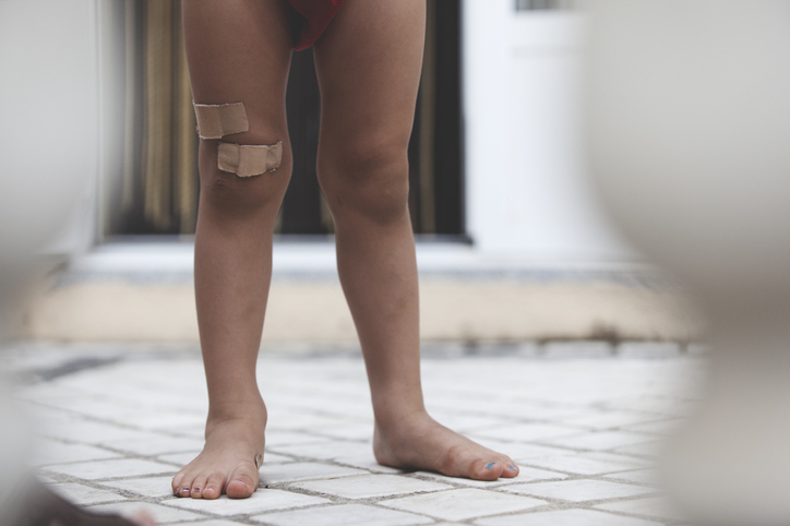 Photograph of the legs of a small child full of small wounds and adhesive bandage.